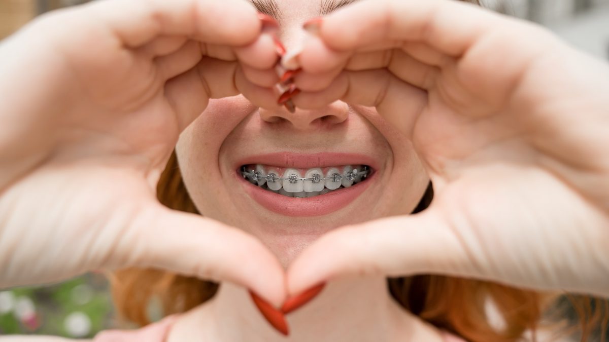 Aligner oder Zahnspange der Kieferorthopädie Spandau Kladow